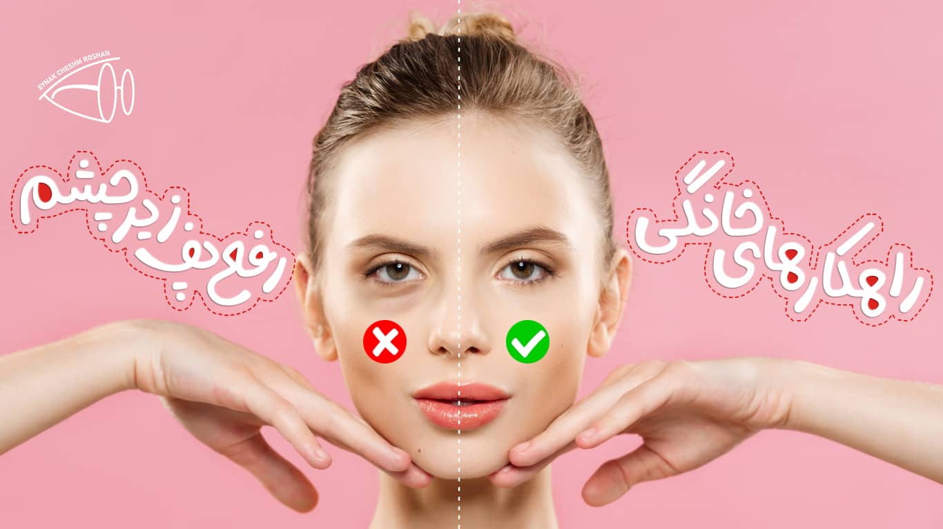 راهکارهای خانگی درمان پف زیر چشم