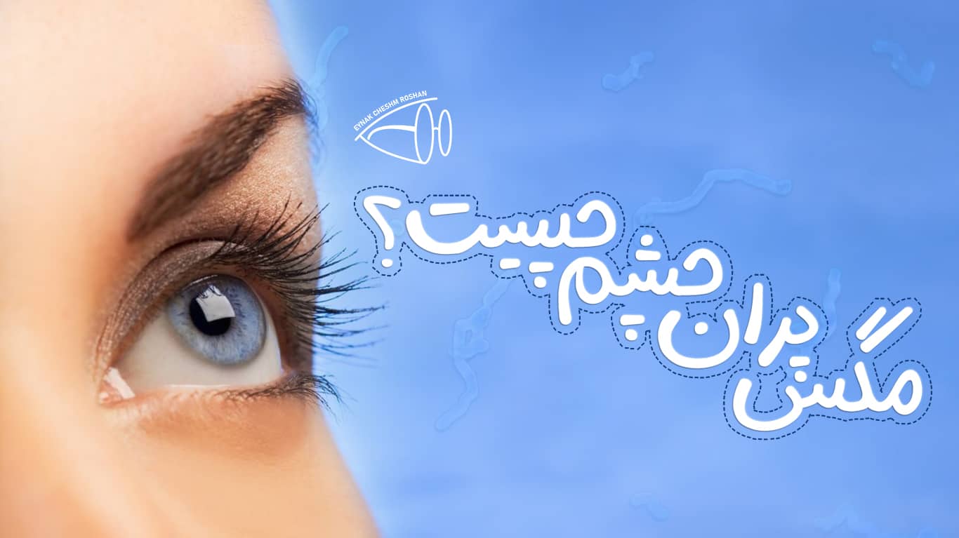 مگس پران چشم چیست؟