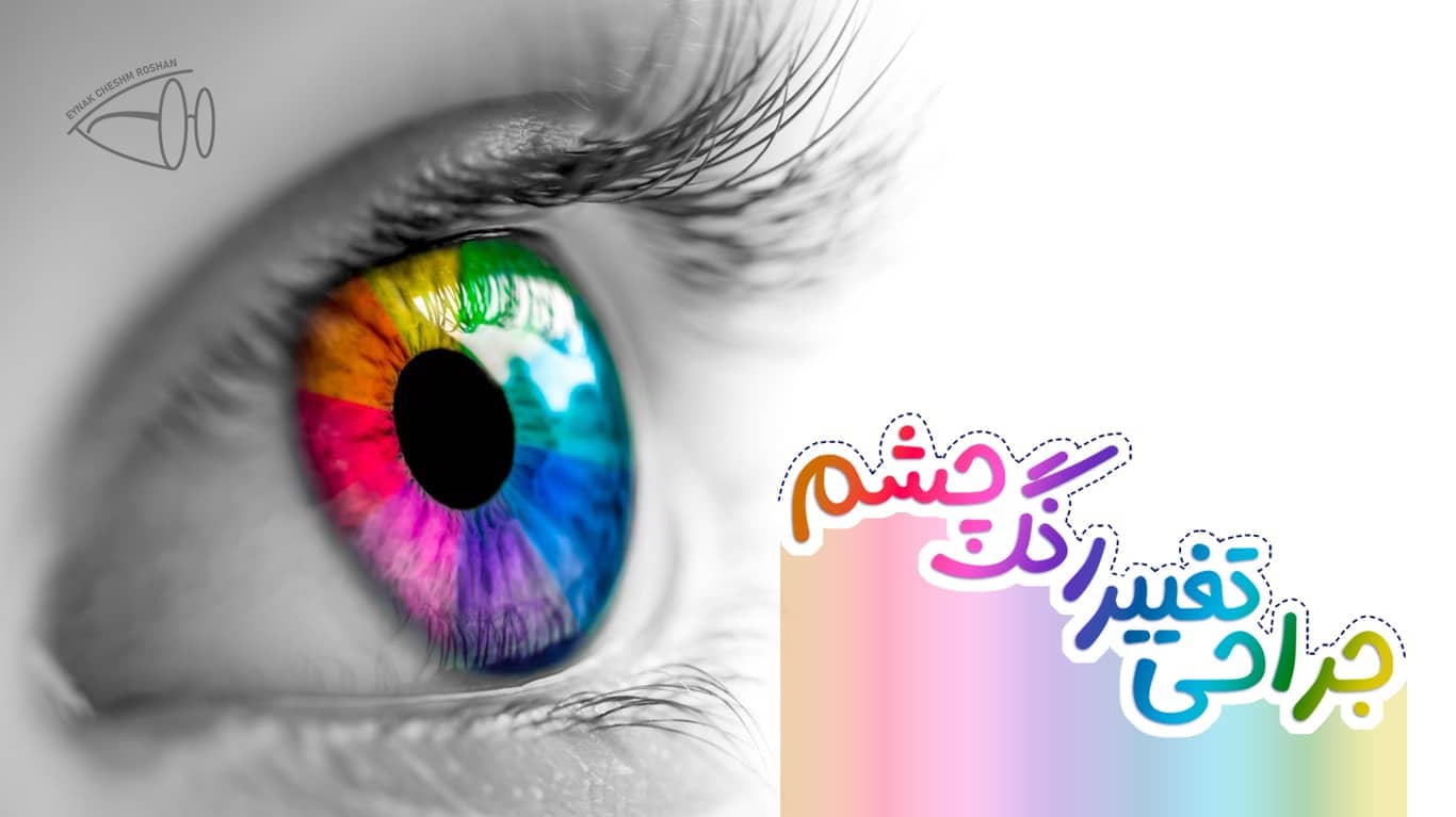 جراحی تغییر رنگ چشم 